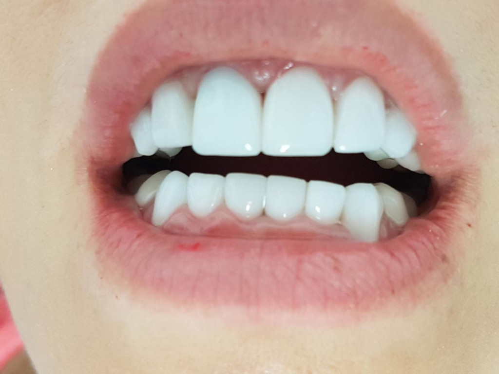 Clínica Dental Bodydent boca