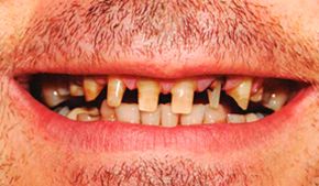 Clínica Dental Bodydent implantes dentales