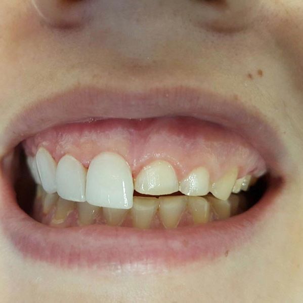 Clínica Dental Bodydent arreglo de dientes