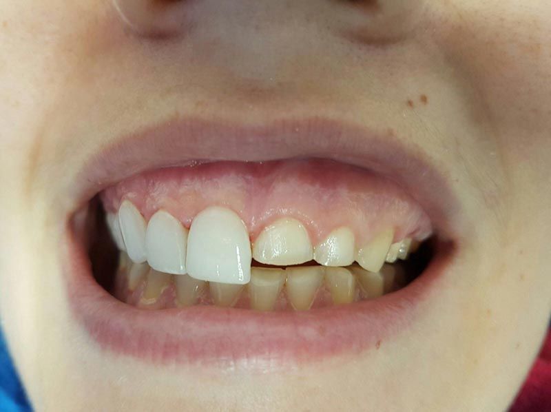 Clínica Dental Bodydent arreglo de dientes