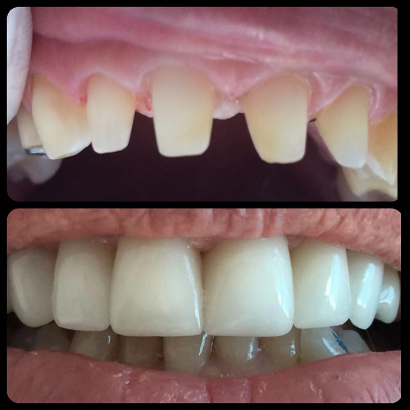 Clínica Dental Bodydent servicios de estética dental