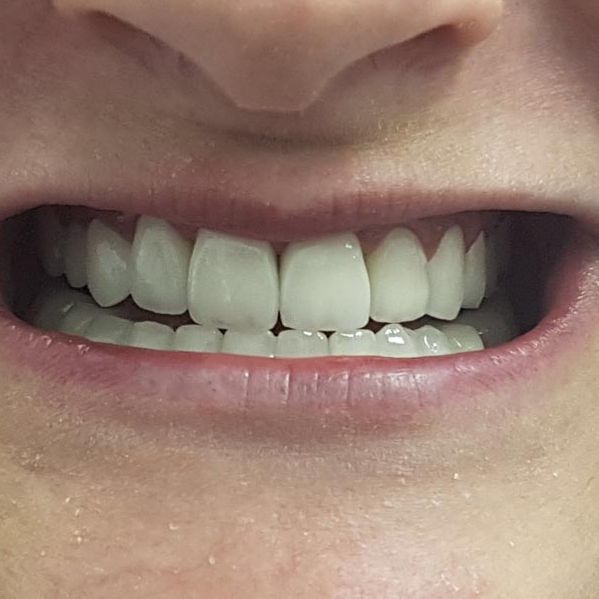 Clínica Dental Bodydent dientes sanos