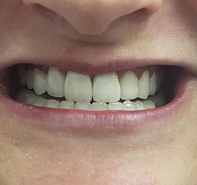 Clínica Dental Bodydent dientes sanos