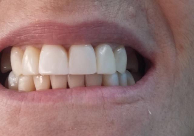 Clínica Dental Bodydent dientes
