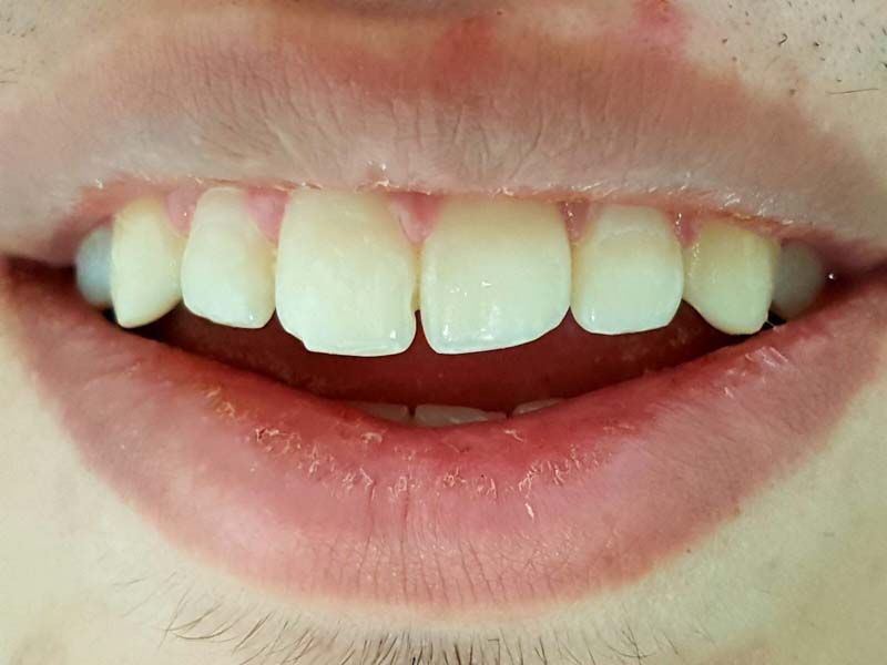 Clínica Dental Bodydent Carillas