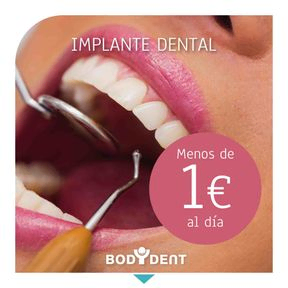 promoción implante dental